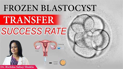 This makes it easier for the embryologist to choose the embryo that is more suitable to implant in the womb. . Blastocyst transfer success rates over 40